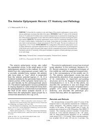 The Anterior Epitympanic Recess: CT Anatomy and Pathology
