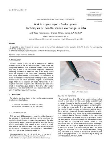 Techniques of needle stance exchange in situ