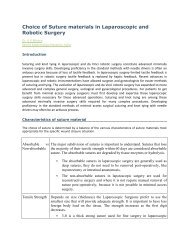 Choice of Suture materials in Laparoscopic and Robotic Surgery