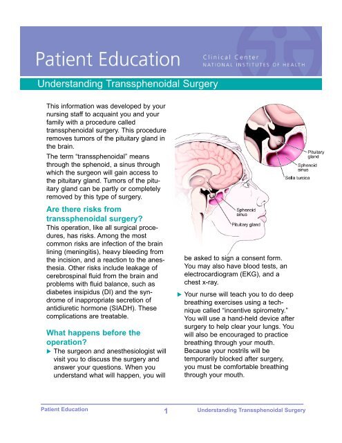 Understanding Transsphenoidal Surgery