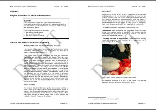 Manual for Male Circumcision under Local Anaesthesia