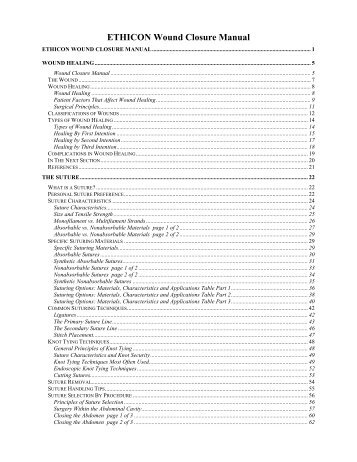 ETHICON Wound Closure Manual - Pilonidal Disease