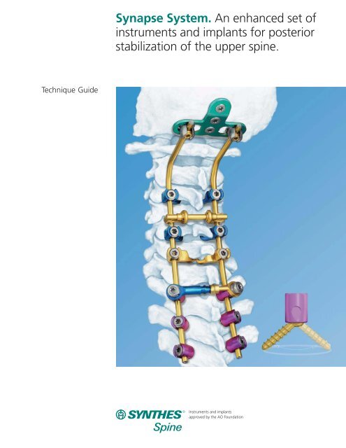 Technique Guide - Synthes