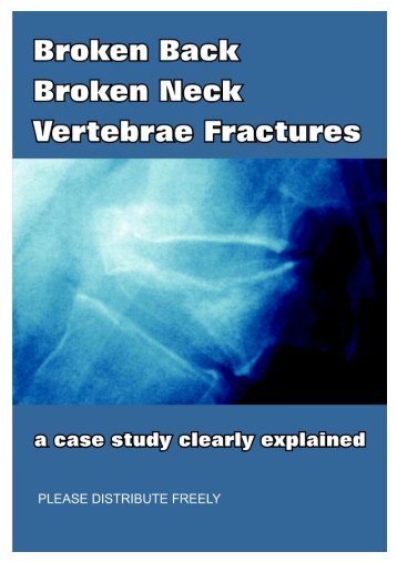 broken neck, broken back, vertebrae fracture