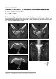 sternocostoclavicular hyperostosis in sapho-syndrome - rbrs