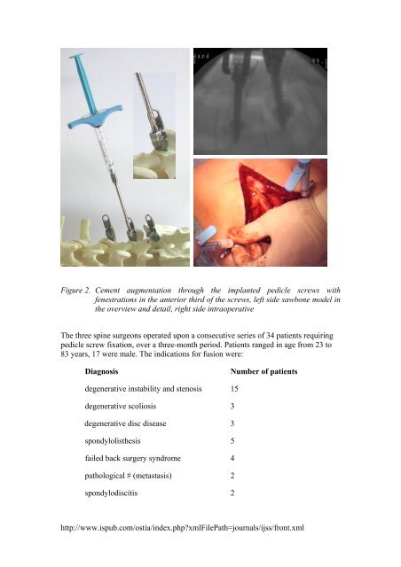 Preliminary experience with the tangoRS: polyaxial, percutaneous ...