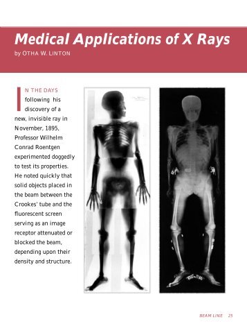 Medical Applications of X Rays - SLAC - Stanford University