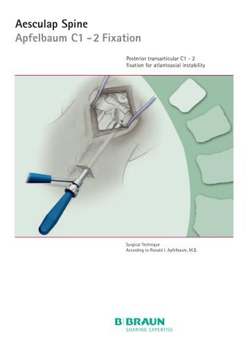 Aesculap Spine Apfelbaum C1 - 2 Fixation - B. Braun Medical AS