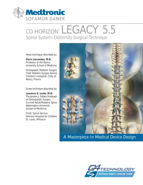 CD HORIZON® LEGACY™ 5.5 - MT Ortho