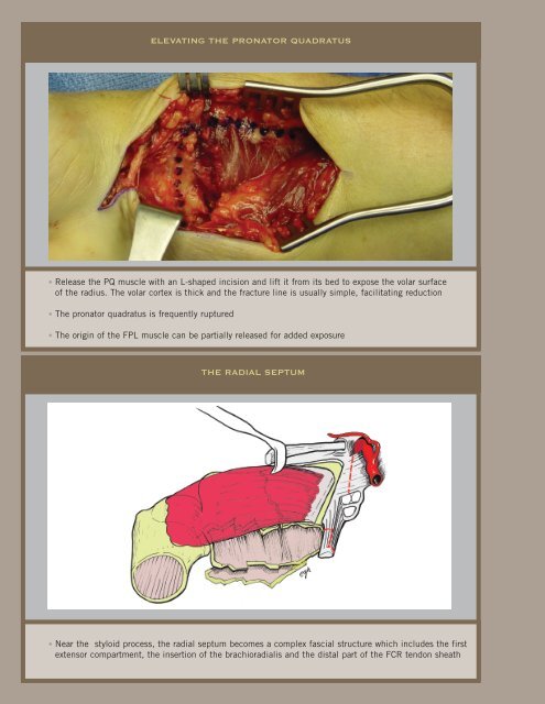 THE ONLY VOLAR PLATE DESIGNED FOR BOTH DORSAL AND ...