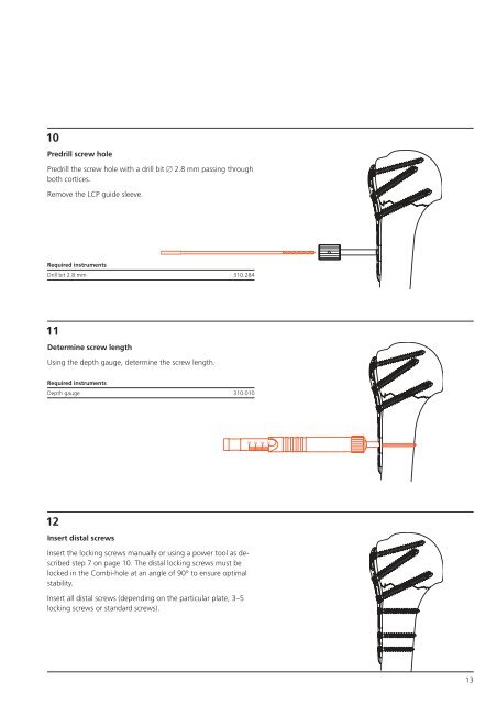 PHILOS + PHILOS Long. - ShoulderDoc.co.uk