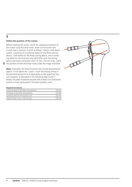 PHILOS + PHILOS Long. - ShoulderDoc.co.uk