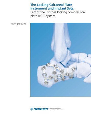 The Locking Calcaneal Plate Instrument and Implant Sets. Part of ...