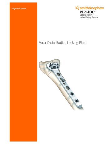 Volar Distal Radius Locking Plate - Wheeless' Textbook of ...