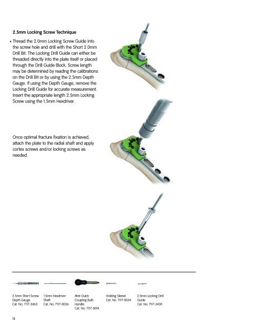 Volar Distal Radius Locking Plate - Wheeless' Textbook of ...