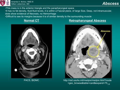 CT Imaging for Soft Tissue Tumors of the Neck