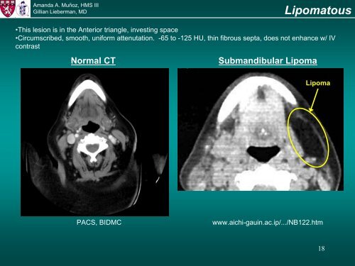 CT Imaging for Soft Tissue Tumors of the Neck