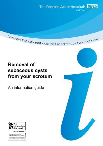 Removal of sebaceous cysts from your scrotum - Pennine Acute ...