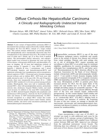 Diffuse Cirrhosis-like Hepatocellular Carcinoma - Rush University ...