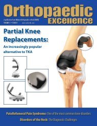 Partial Knee Replacements: - Midwest Orthopaedics at Rush