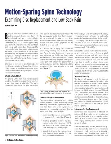 Motion-Sparing Spine Technology - Midwest Orthopaedics at Rush