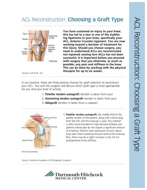 ACL Reconstruction Guidebook (2.2MB) - Dartmouth-Hitchcock