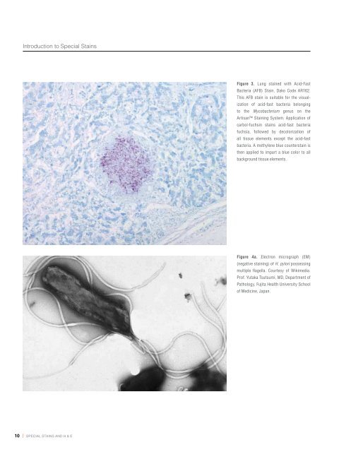 Chapter 1 | Introduction to Special Stains - Dako