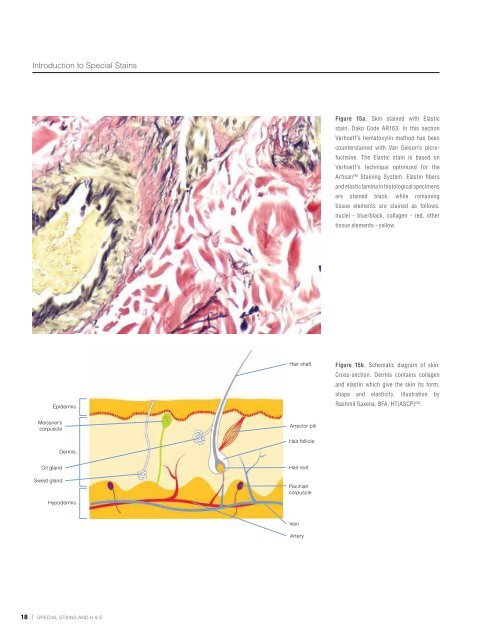 Chapter 1 | Introduction to Special Stains - Dako