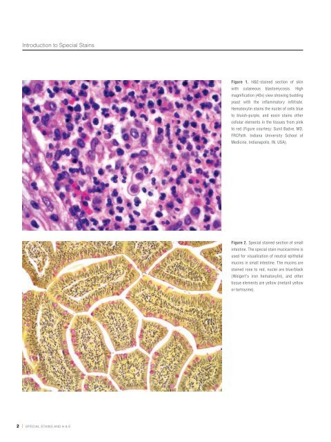 Chapter 1 | Introduction to Special Stains - Dako