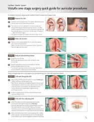 Vistafix one-stage surgery quick guide for auricular ... - Cochlear