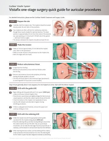 Vistafix one-stage surgery quick guide for auricular ... - Cochlear