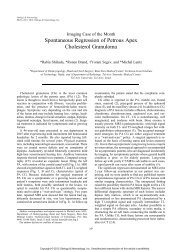 Spontaneous Regression of Petrous Apex Cholesterol Granuloma