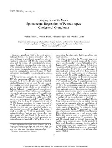 Spontaneous Regression of Petrous Apex Cholesterol Granuloma