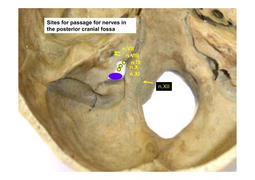 Cavities and spaces of the skull, paranasal sinuses, opening in the ...
