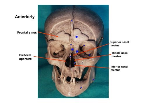 Cavities and spaces of the skull, paranasal sinuses, opening in the ...