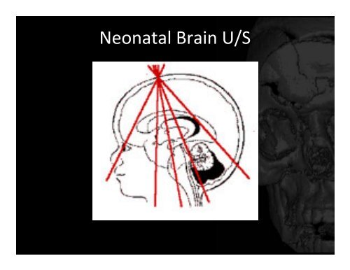 Skull and Dura - Department of Medical Imaging - University of Toronto