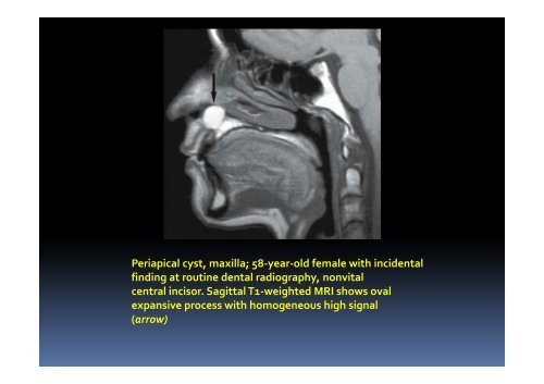 Maxillofacial Imaging Anatomy CT AND MRI imaging