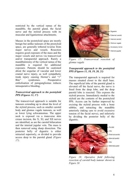 Access to Parapharyngeal Space - Vula - University of Cape Town