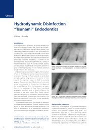 “Tsunami” Endodontics - International Dentistry SA - Modern ...