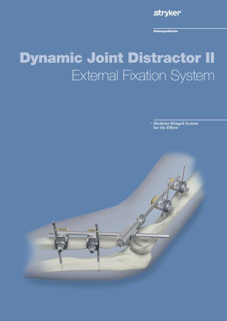 Dynamic Joint Distractor II External Fixation System - Stryker