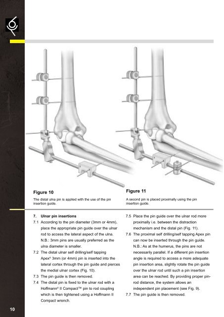 DJD External Fixator, Stryker - ShoulderDoc.co.uk