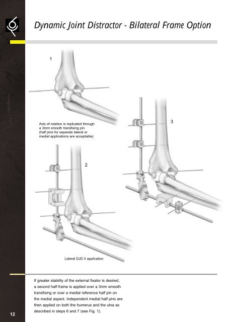 DJD External Fixator, Stryker - ShoulderDoc.co.uk