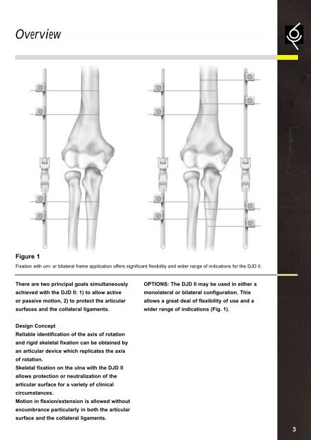 DJD External Fixator, Stryker - ShoulderDoc.co.uk