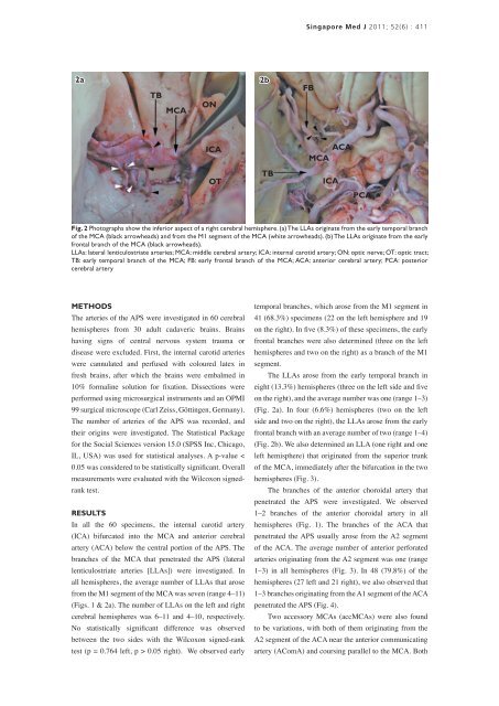 Arterial vascularisation of the anterior perforated ... - APAMED Central