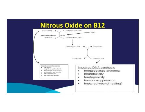 Nitrous Oxide - MCI