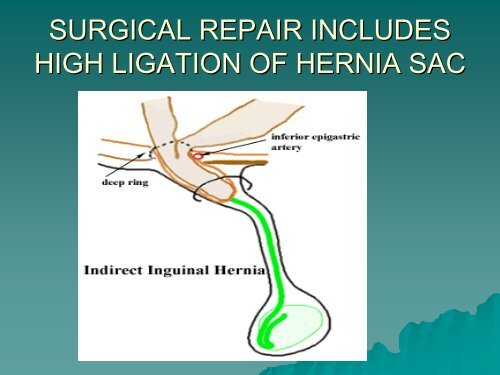 The Abdominal Wall And Hernias