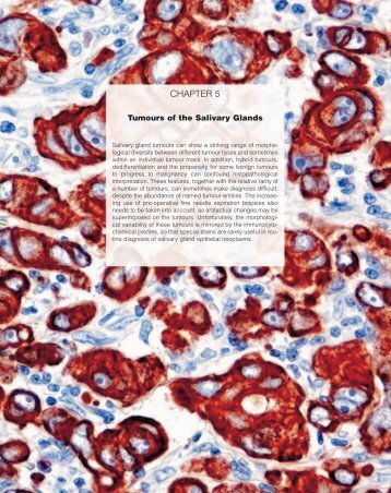 Tumours Of The Salivary Glands - iarc