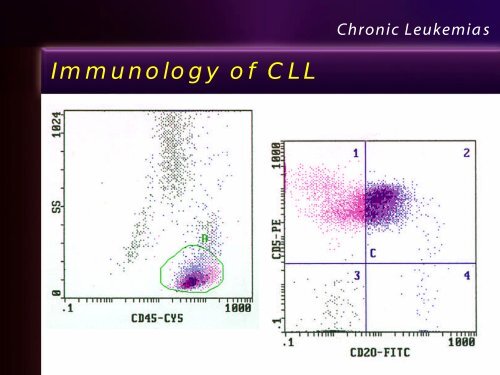 Leukemia Lecture Part 2 - Pathology