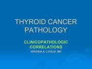 Pathologies of Thyroid Cancer