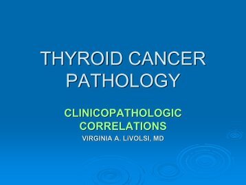 Pathologies of Thyroid Cancer
